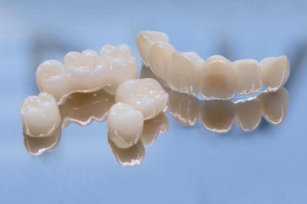7 ventajas de las coronas de zirconio - Imagen 1