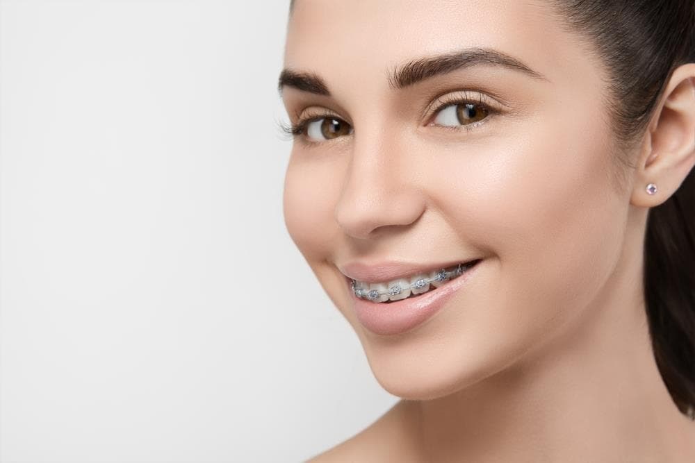 Cómo elegir el mejor tratamiento de ortodoncia para ti