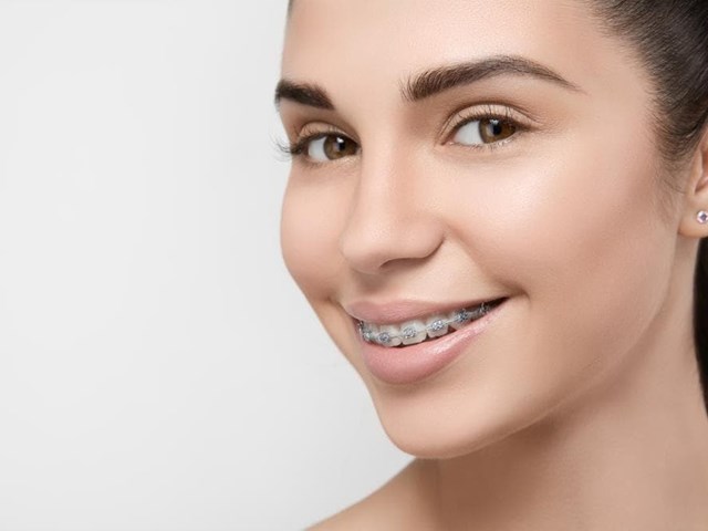 Cómo elegir el mejor tratamiento de ortodoncia para ti