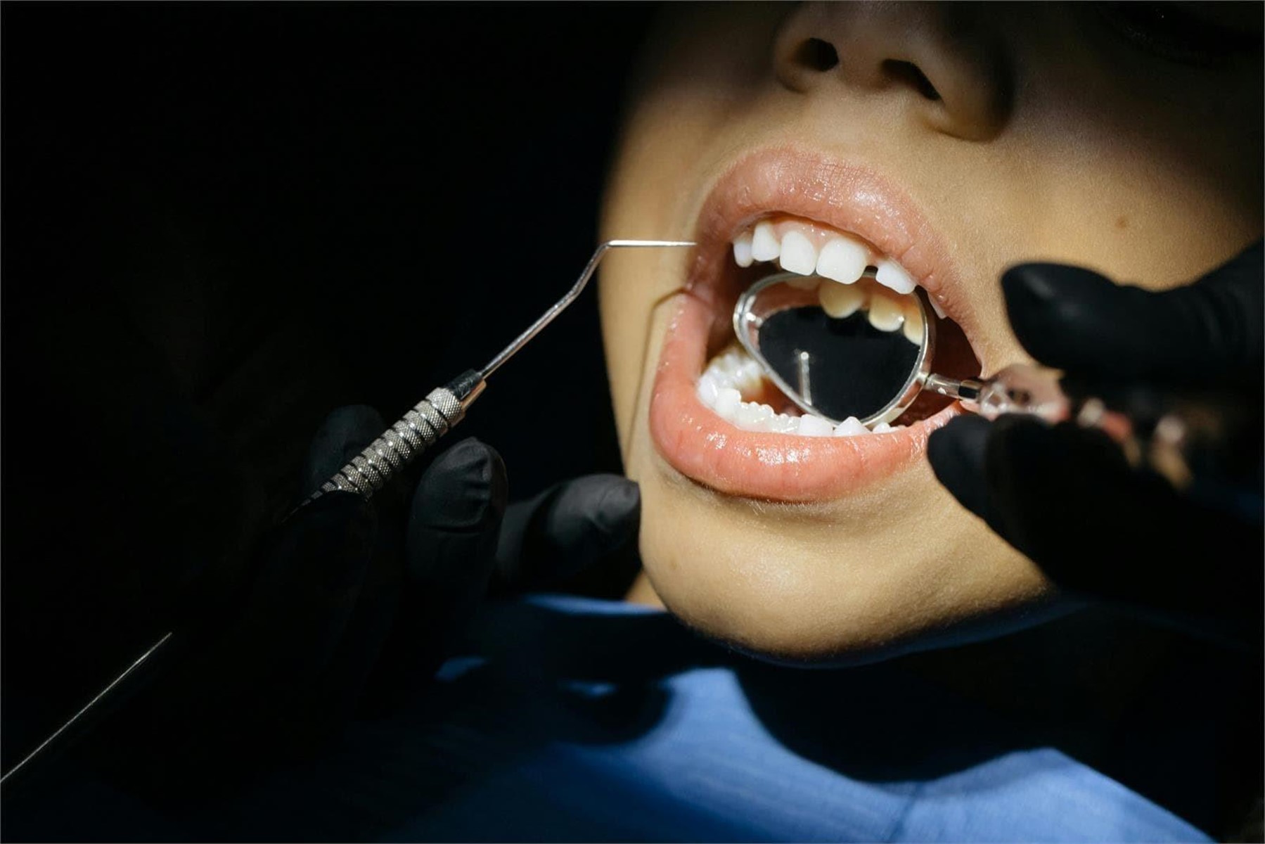 Consejos para evitar las caries en los más pequeños