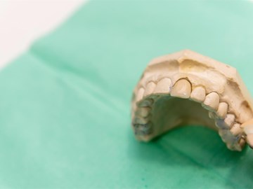 ¿Cuándo es recomendable utilizar prótesis dentales? 