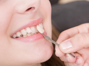 Diferencias entre los distintos tipos de restauraciones dentales