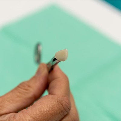 Especialistas en odontología restauradora en A coruña
