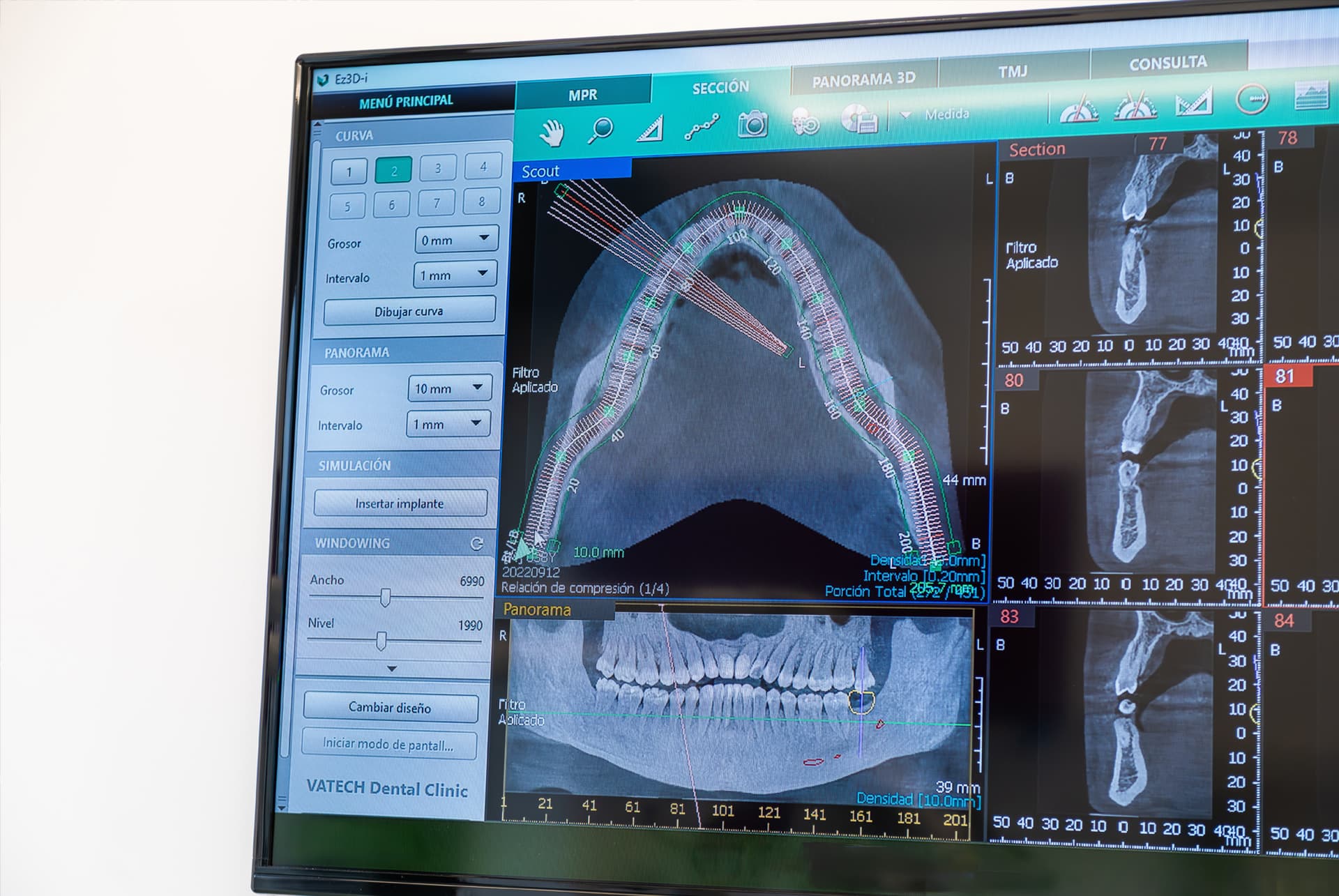 TAC dental en A Coruña