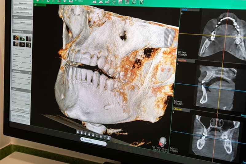 Tomografía 3d dental en A Coruña