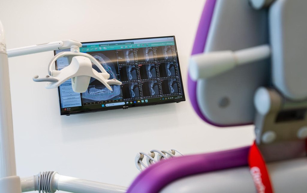 Mantenimiento periodontal para unas encías sanas