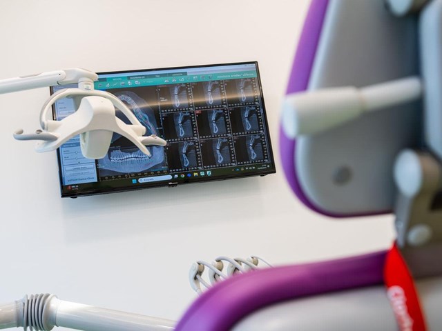 Mantenimiento periodontal para unas encías sanas