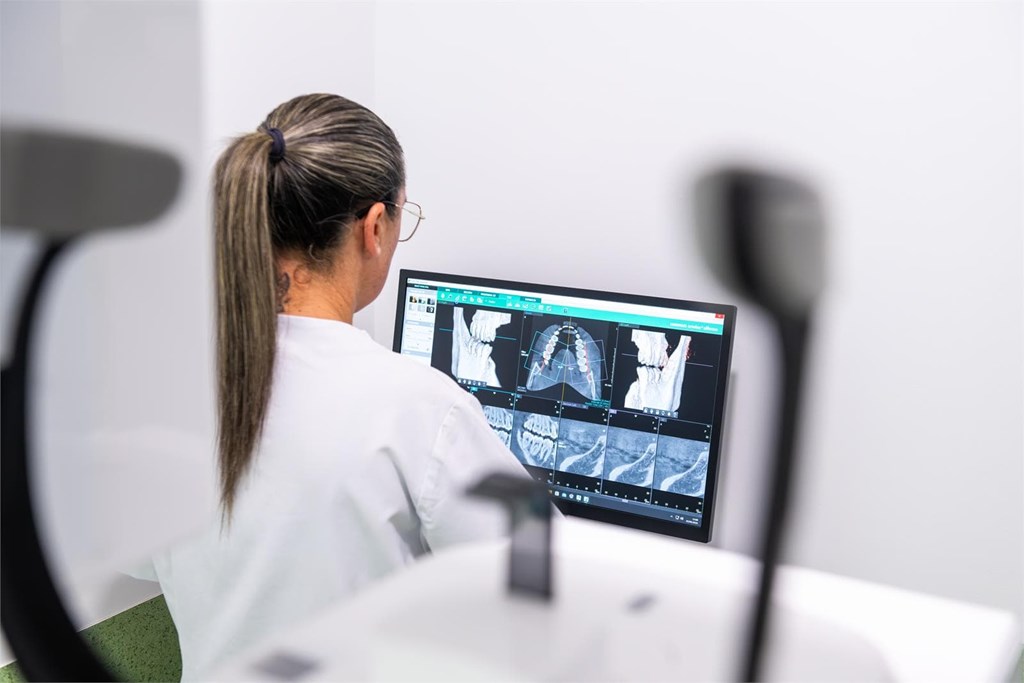 ¿Necesito una elevación de seno para mis implantes?