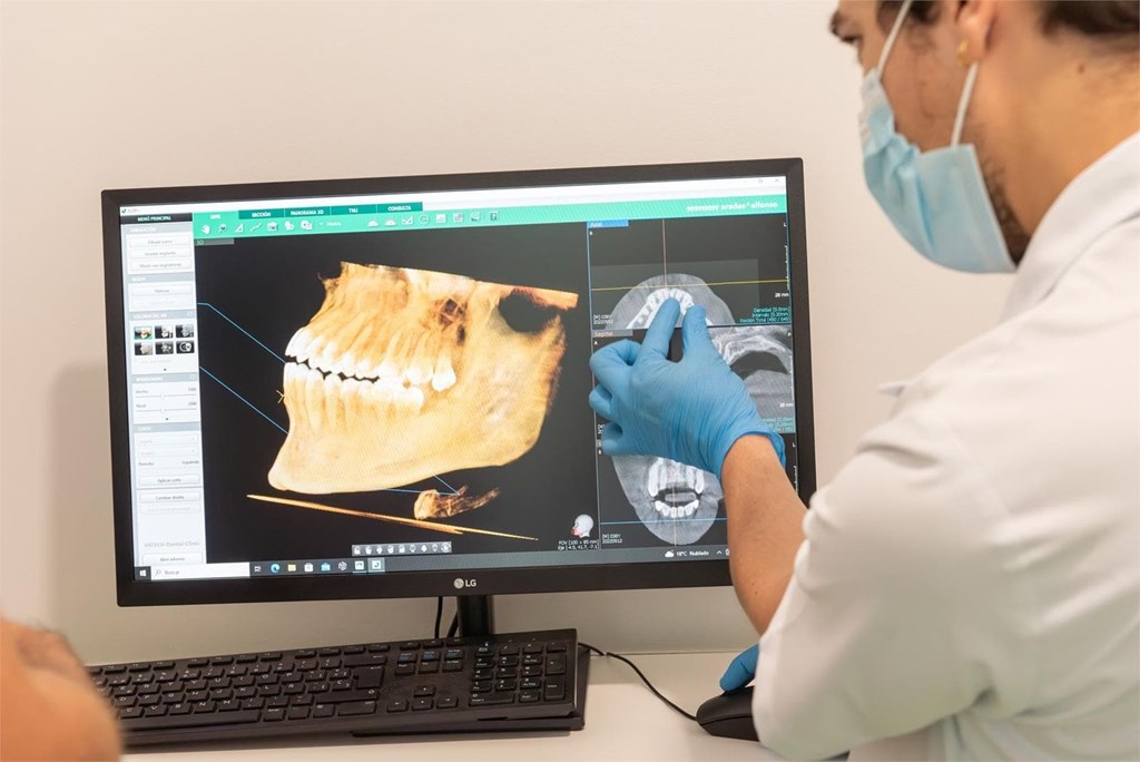 ¿Por qué me piden un TAC dental? La importancia del diagnóstico 3D