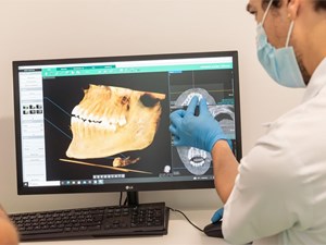 ¿Por qué me piden un TAC dental? La importancia del diagnóstico 3D