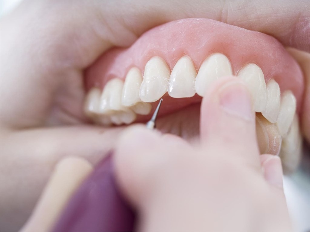 ¿Qué son y cuál es la finalidad de las prótesis dentales?