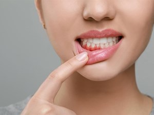 ¿Sangran tus encías? Podría ser gingivitis. ¡Actúa antes de que sea tarde!