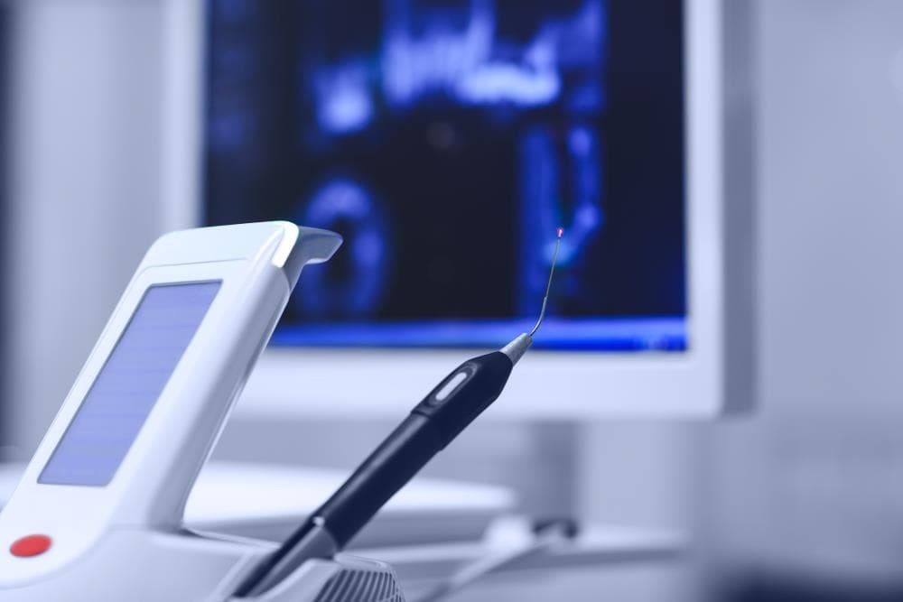 ¿Sirve el láser dental para tratar problemas periodontales?